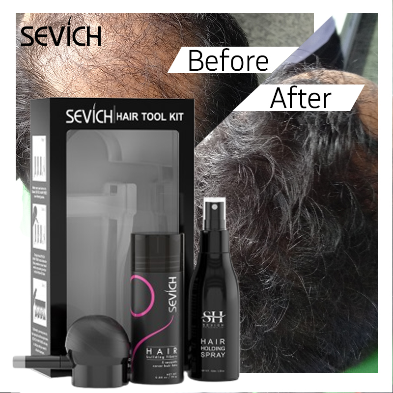 Serat Rambut Hitam Set Serat P - Keratin Treatment Set ulasan dan harga